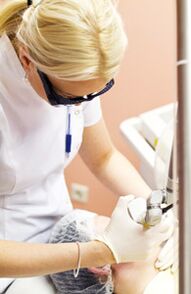 Liječnik provodi postupak fototermolize