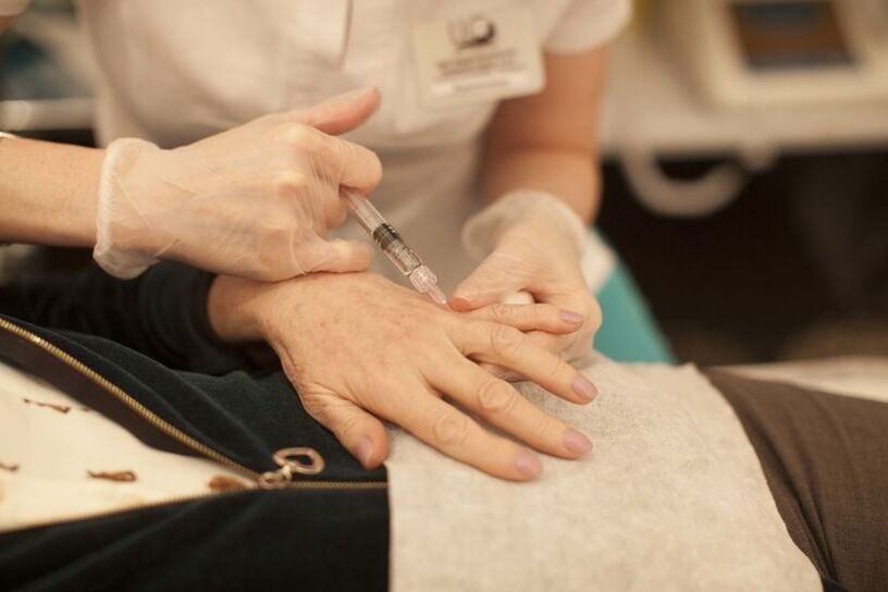 injekcijsko pomlađivanje kože ruku